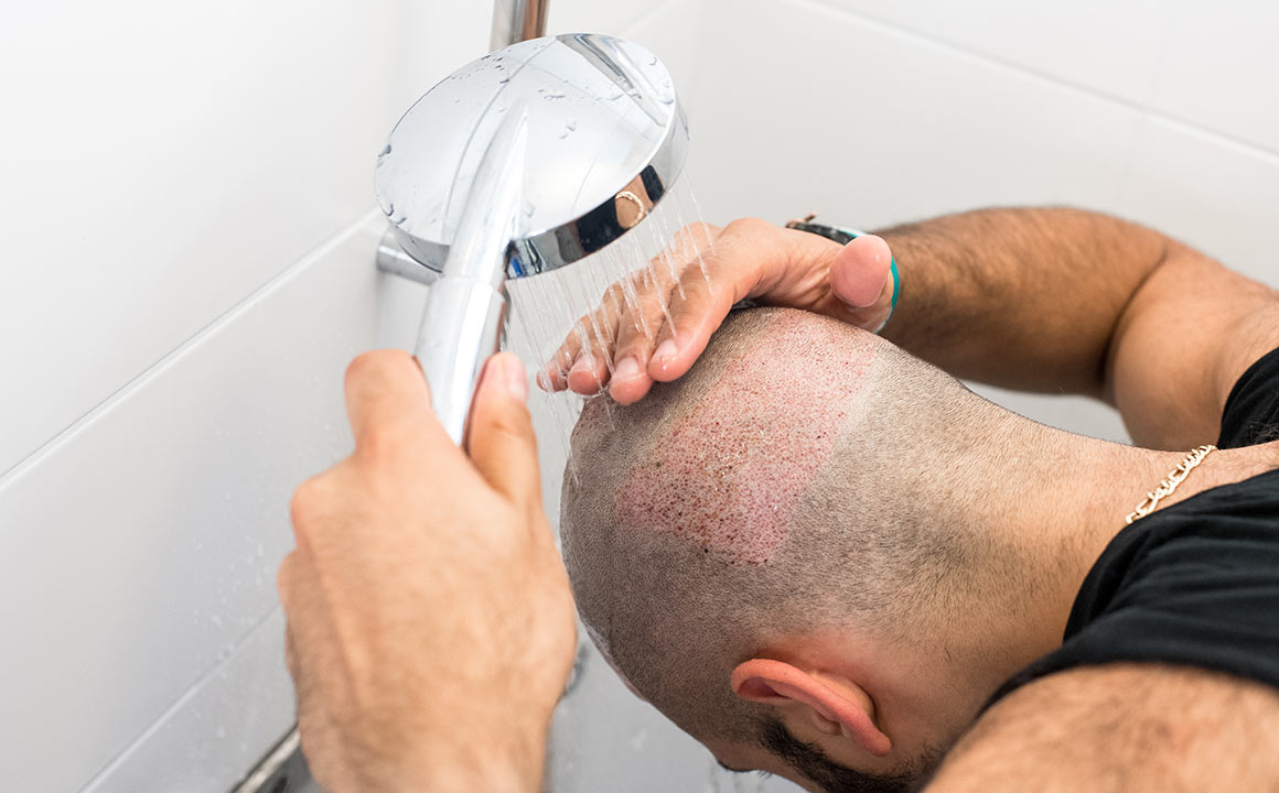 Man washes back of head with water
