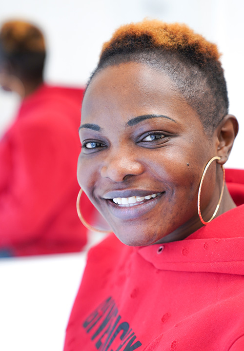 Results after hair transplant on woman with African hair